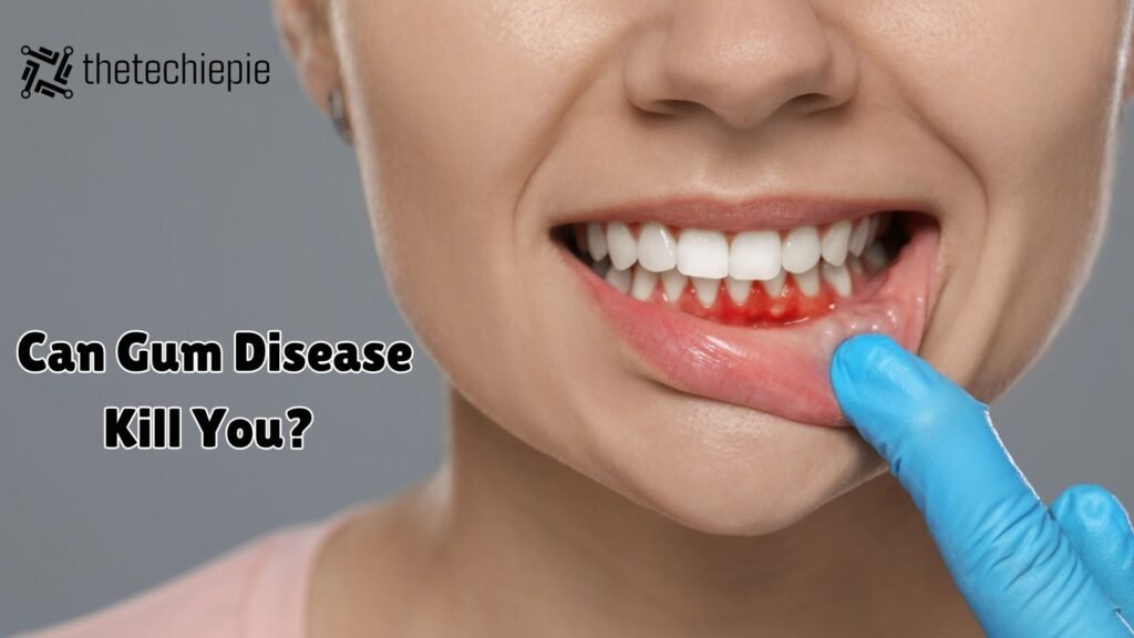 can gum disease kill you