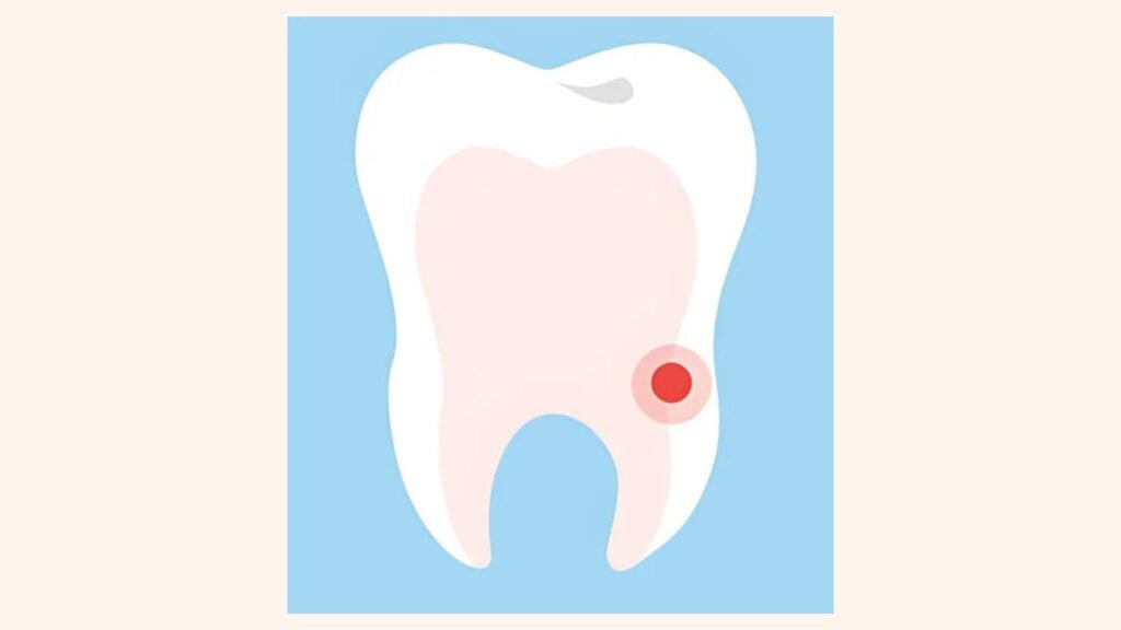 Root Cavities
