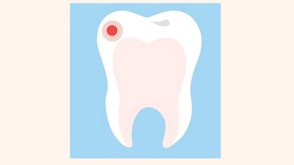 Smooth-Surface Cavities